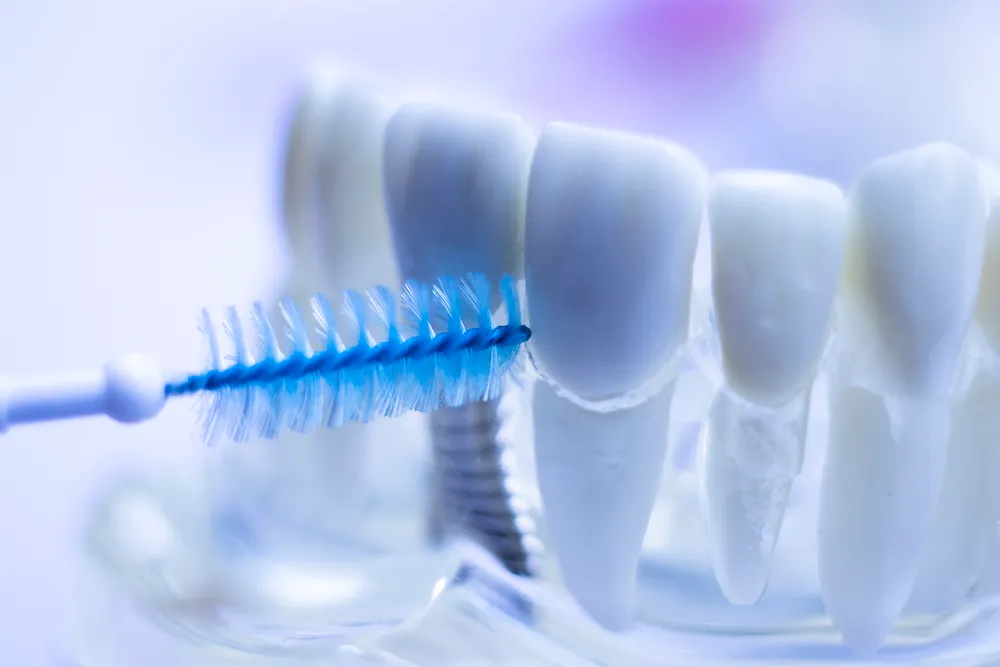 İnterdental fırçaların dişlər üçün faydaları